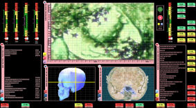  Microcellular Brain Scans